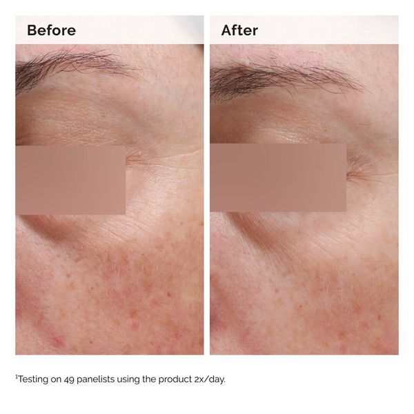 Niacinamide 5% Face and Body Emulsion - Image 3