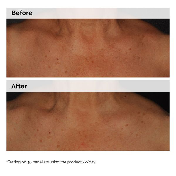 Niacinamide 5% Face and Body Emulsion - Image 2